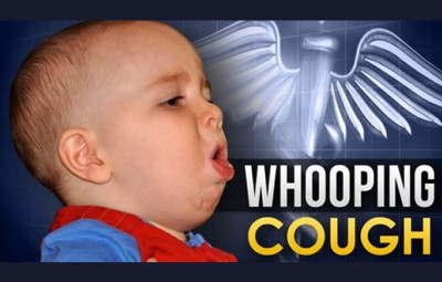百日咳 - Whooping coughにご注意